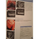 Robert H. Hawes - Endosonography - 2006 - Cartonata