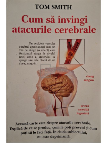 Tom Smith - Cum sa invingi atacurile cerebrale - 2006 - Brosata