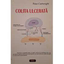 Colita ulcerata