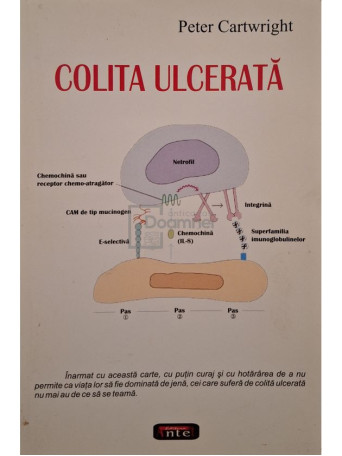 Peter Cartwright - Colita ulcerata - 2007 - Brosata