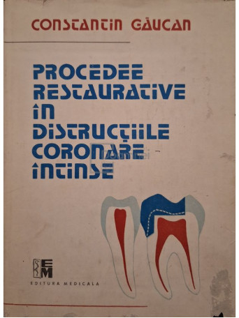 Constantin Gaucan - Procedee restaurative in distructiile coronare intinse - 1989 - Cartonata