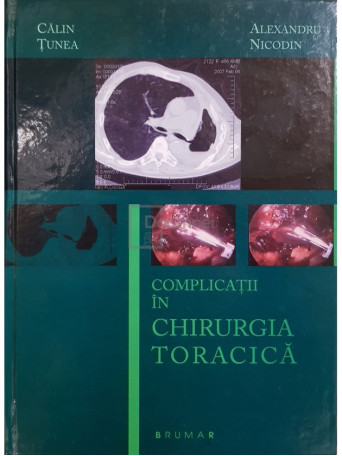 Calin Tunea - Complicatii in chirurgia toracica - 2008 - Cartonata