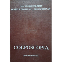Colposcopia