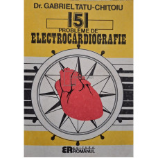 151 probleme de electrocardiografie