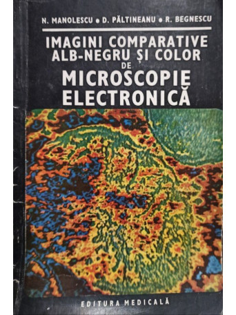 Imagini comparative alb-negru si color de microscopie electronica